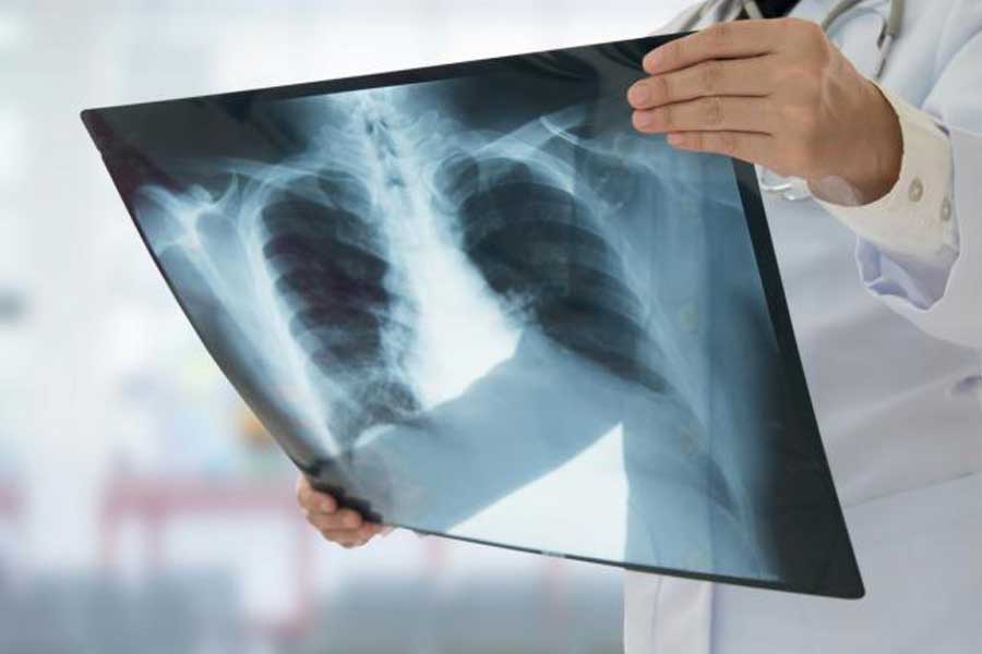 Radiografie a domicilio: tutti i vantaggi